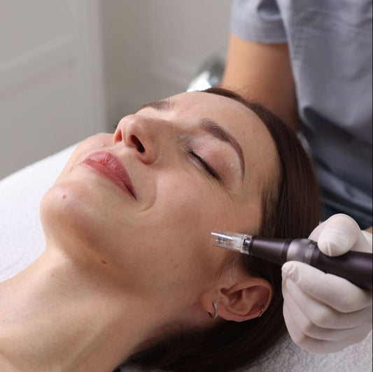 What is Microneedling? A Natural Way to Rejuvenate Your Skin