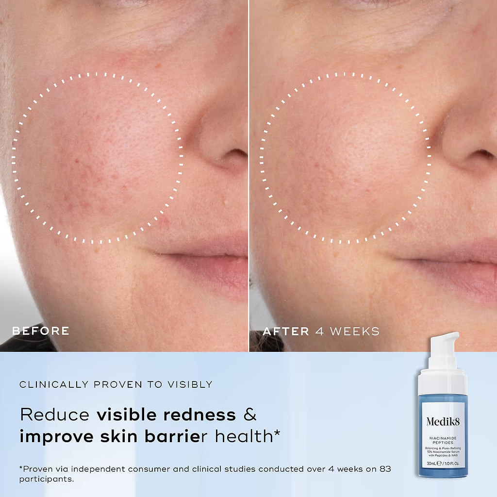 Niacinamide Peptides 30 ml